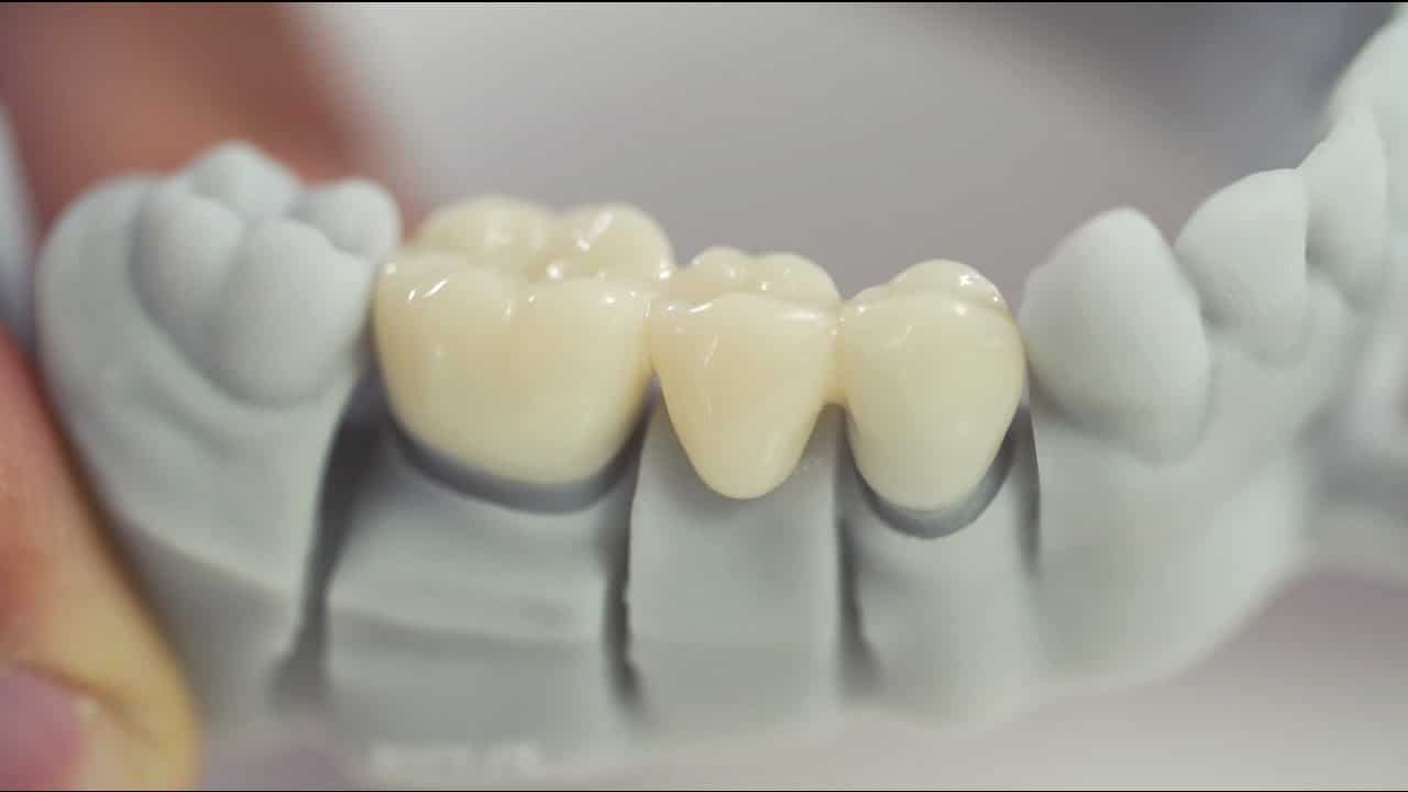 3d printer teeth