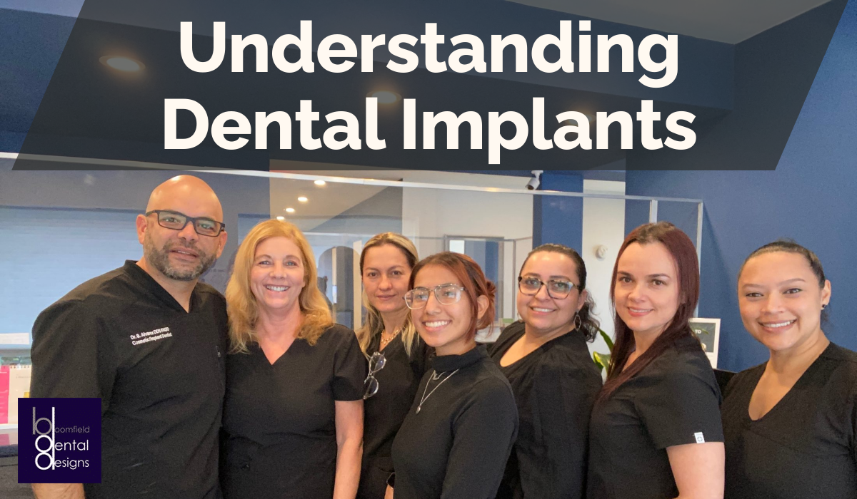 Understanding Dental Implants
