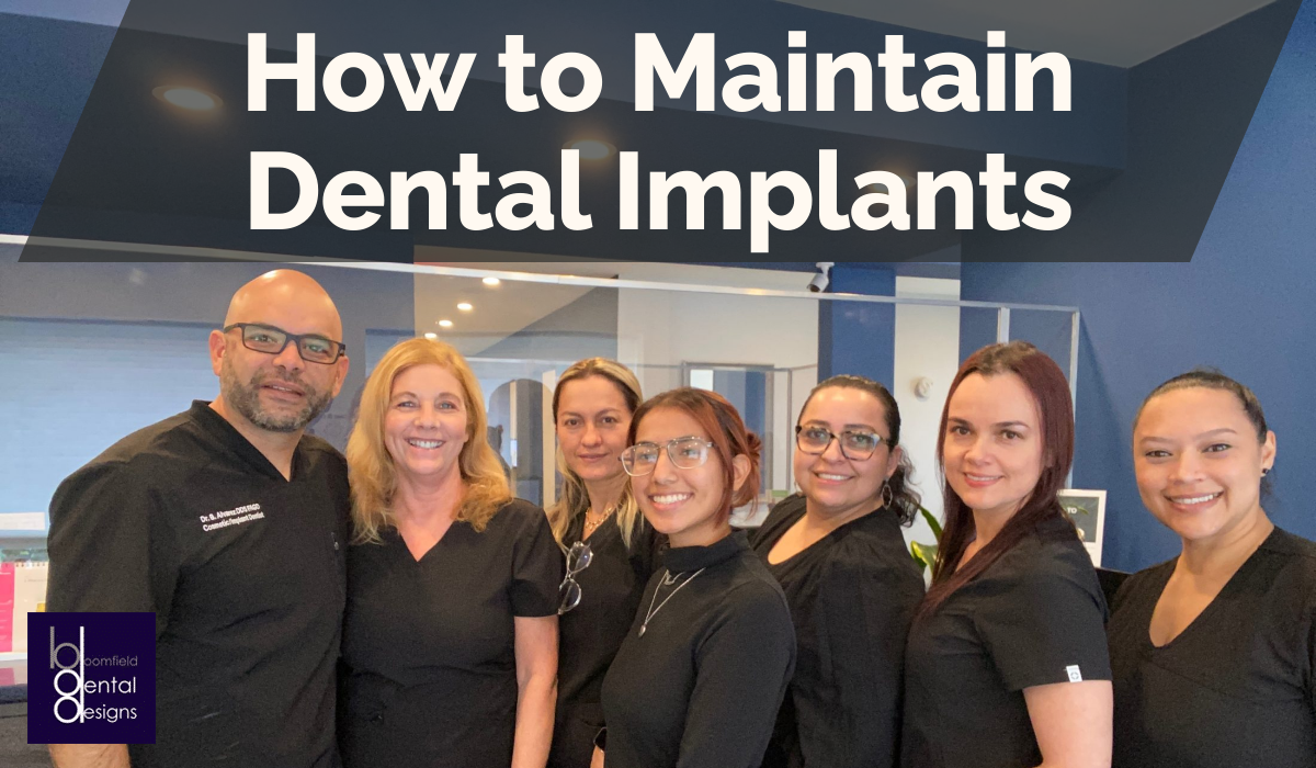 How to Maintain Dental Implants