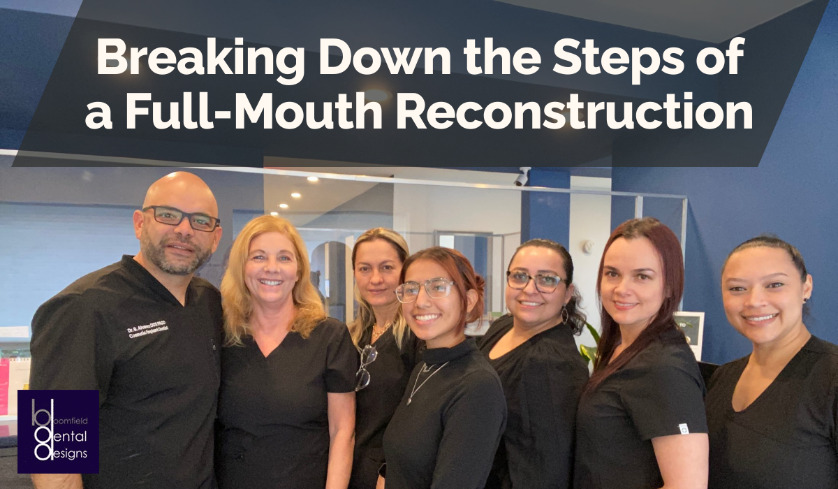 Breaking Down the Steps of a Full-Mouth Reconstruction