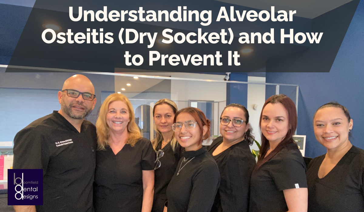 Understanding Alveolar Osteitis (Dry Socket) and How to Prevent It